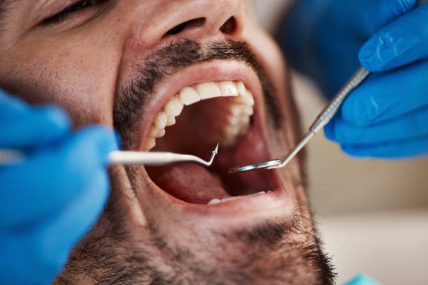 Best Tooth Pain Emergency Relief  in Palmetto, GA