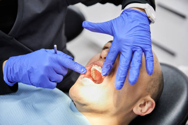 Best Root Canal Emergency Dentist  in Palmetto, GA